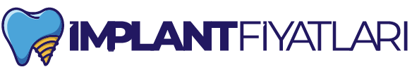 Diş İmplant Fiyatları